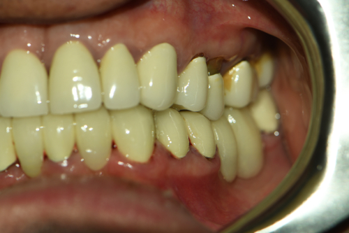 Great Neck Dental Arts | Pediatric Dentistry, Periodontal Treatment and Sports Mouthguards