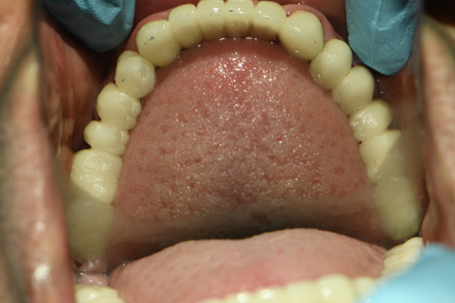 Great Neck Dental Arts | Root Canals, Oral Exams and Implant Dentistry