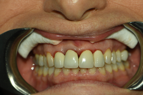 Dentist in Great Neck