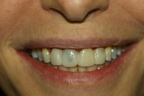 Great Neck Dental Arts | Periodontal Treatment, Root Canals and Preventative Program