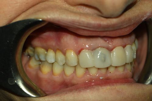 Great Neck Dental Arts | Pediatric Dentistry, Dental Bridges and Implant Dentistry