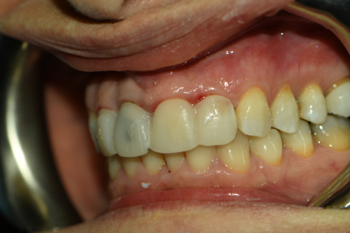 Great Neck Dental Arts | Teeth Whitening, iTero Element&reg; 5D scanner and Oral Exams