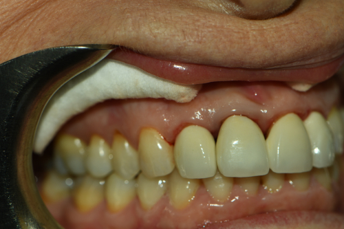 Dentist in Great Neck