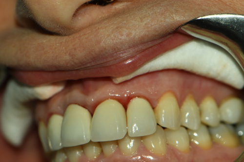 Dentist in Great Neck