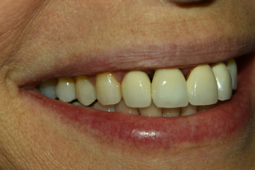 Great Neck Dental Arts | Extractions, Night Guards and Invisalign&reg;