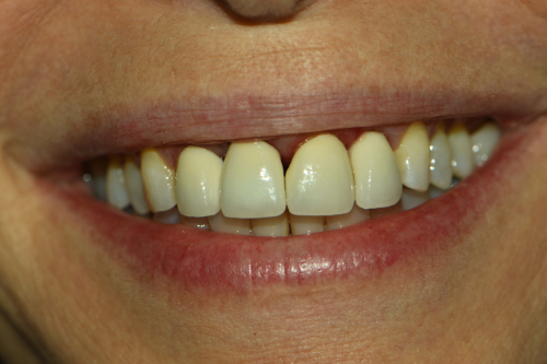 Great Neck Dental Arts | Root Canals, Oral Exams and Implant Dentistry