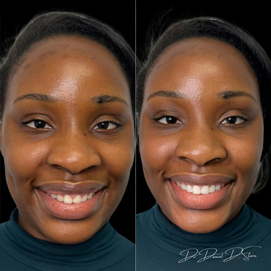 Great Neck Dental Arts | Extractions, Night Guards and Invisalign reg