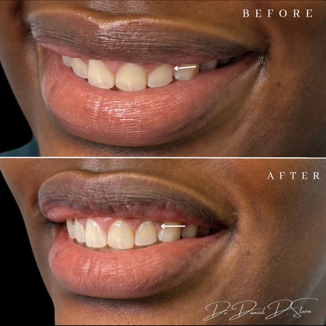 Great Neck Dental Arts | Pediatric Dentistry, Periodontal Treatment and Sports Mouthguards